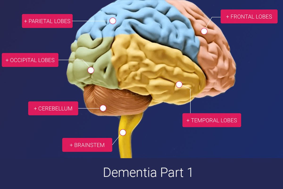 an image of the brain, representing what happens in the brain when dementia takes over