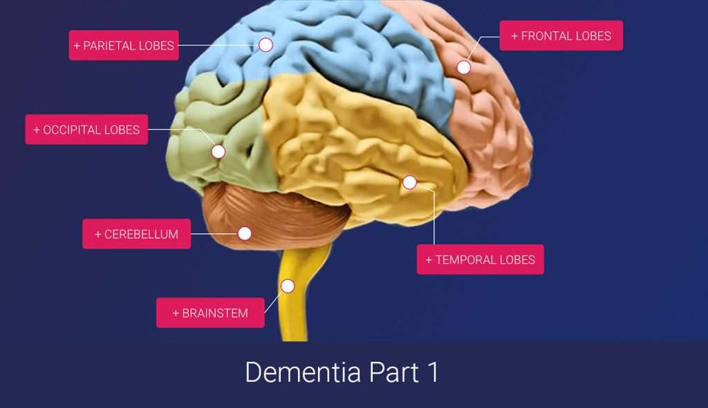 Dementia 1 - Understanding the brain and the pathology of dementia course